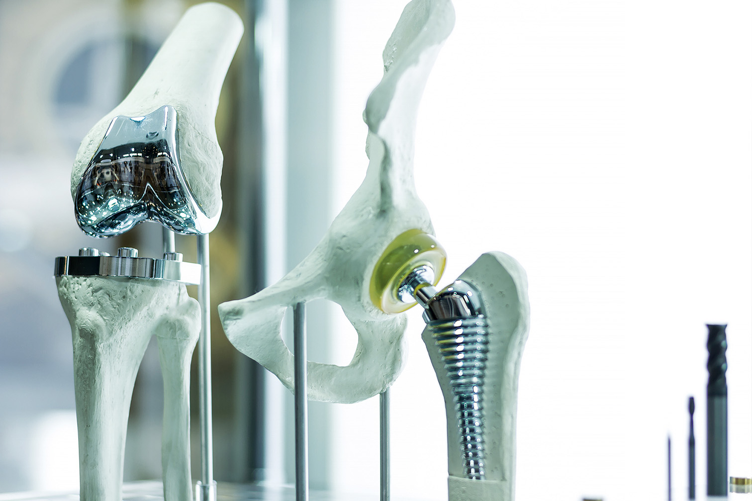 Hüft- und Knieendoprothetik mit modernster Robotertechnologie